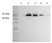 ICL | Isocitrate lyase in the group Antibodies Plant/Algal / Carbohydrates at Agrisera AB (Antibodies for research) (AS09 500)